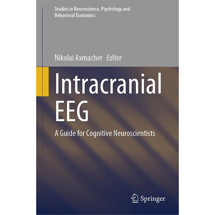 Intracranial EEG: A Guide for Cognitive Neuroscientists