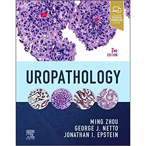 Uropathology