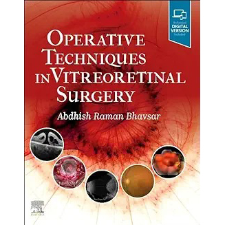 Operative Techniques in Vitreoretinal Surgery