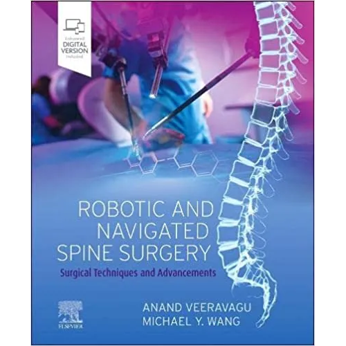 Robotic and Navigated Spine Surgery