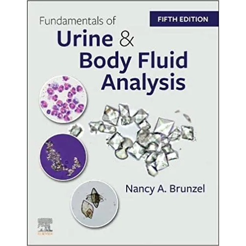Fundamentals of Urine & Body Fluid Analysis