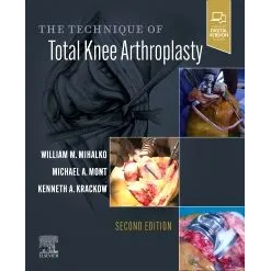 The Technique of Total Knee Arthroplasty