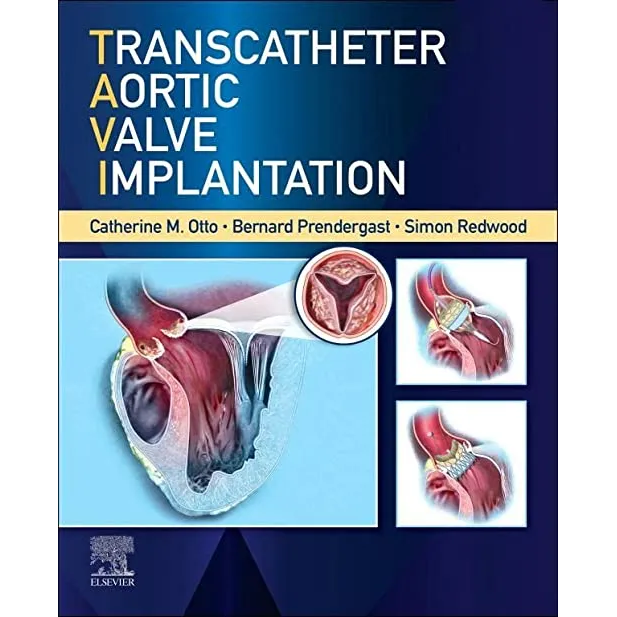 Transcatheter Aortic Valve Implantation