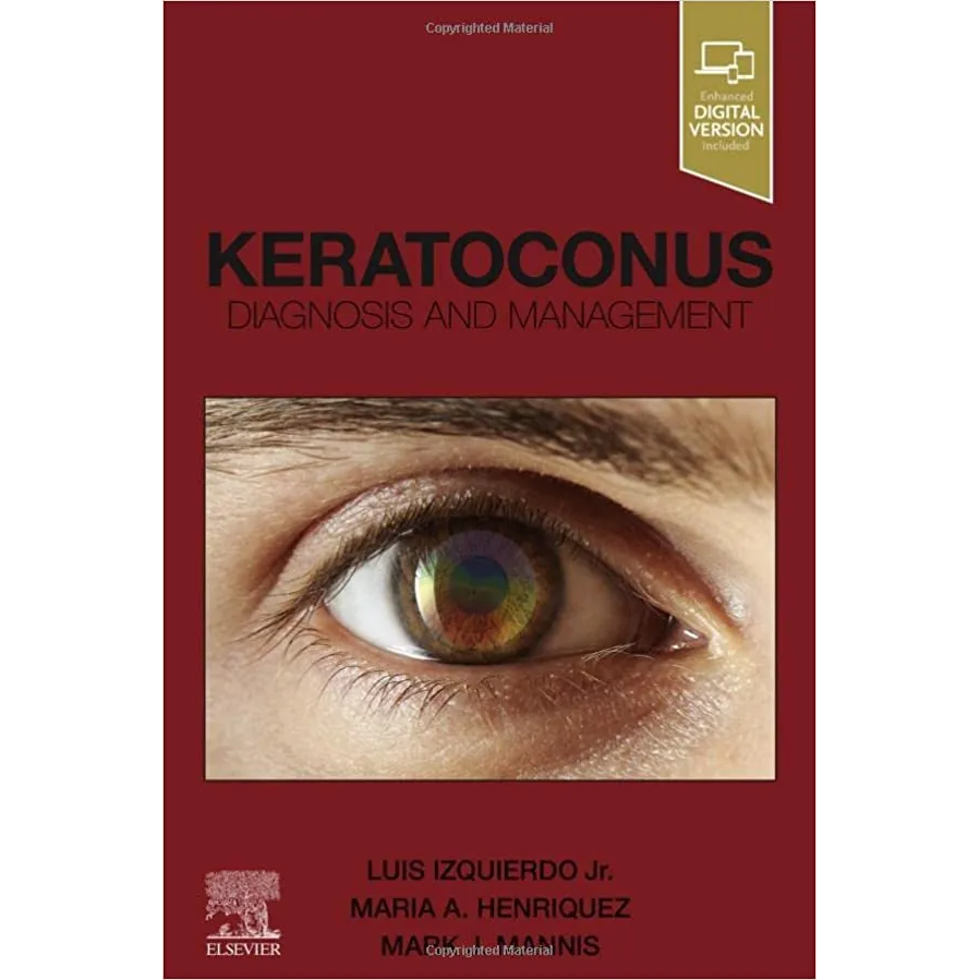 Keratoconus: Diagnosis and Management