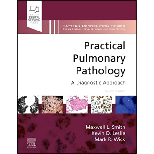 Practical Pulmonary Pathology: A Diagnostic Approach