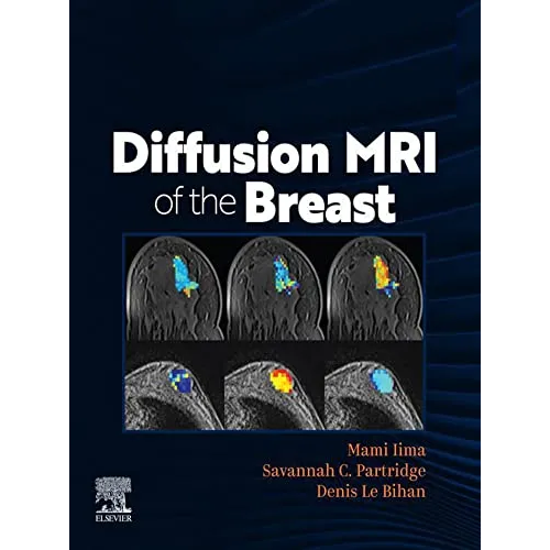 Diffusion MRI of the Breast