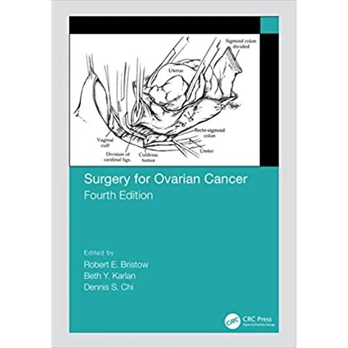 Surgery for Ovarian Cancer