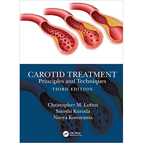Carotid Treatment: Principles and Techniques