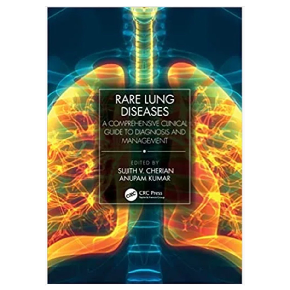 Rare Lung Diseases: A Comprehensive Clinical Guide to Diagnosis and Management