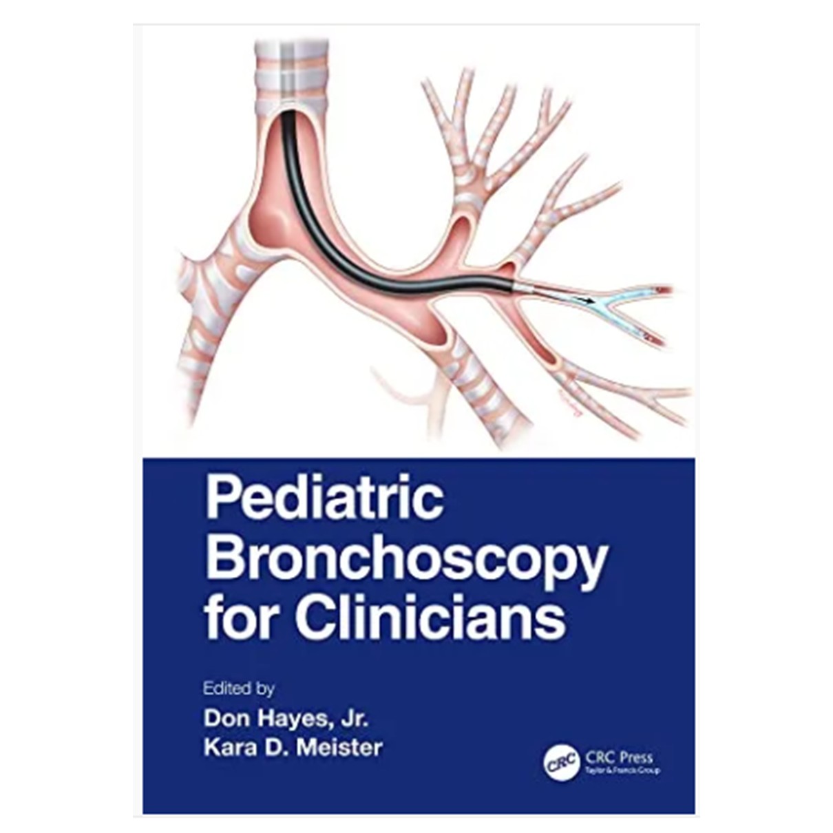 Pediatric Bronchoscopy for Clinicians