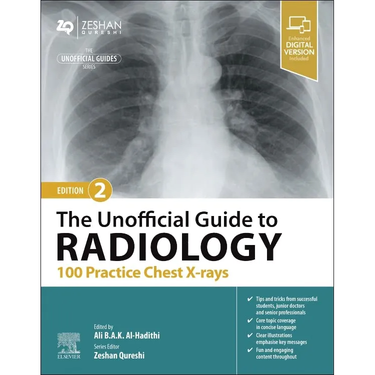 The Unofficial Guide to Radiology: 100 Practice Chest X-rays