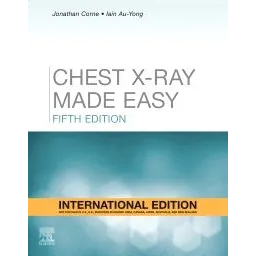 Chest X-Ray Made Easy (IE)
