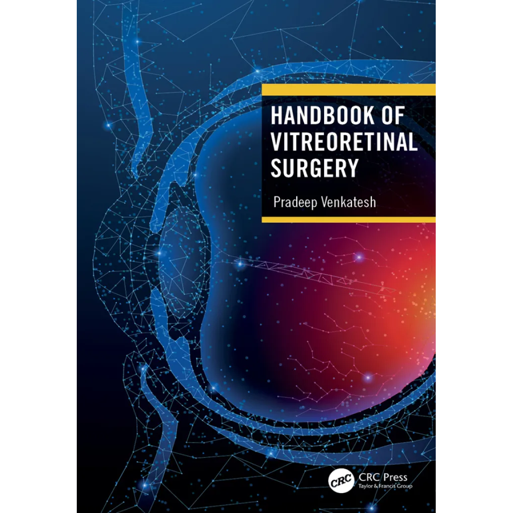 Handbook of Vitreoretinal Surgery