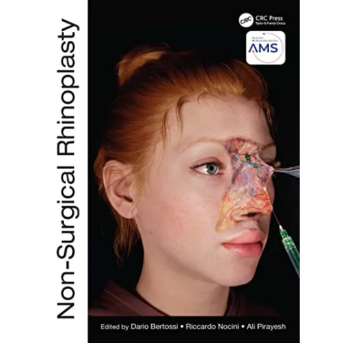 Non-Surgical Rhinoplasty