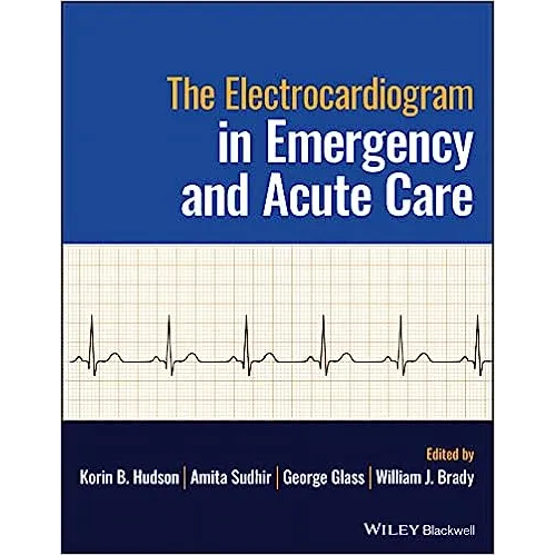 The Electrocardiogram in Emergency and Acute Care