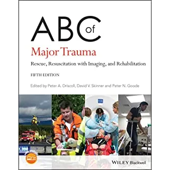 ABC of Major Trauma: Rescue,Resuscitation with Imaging,and Rehabilitation