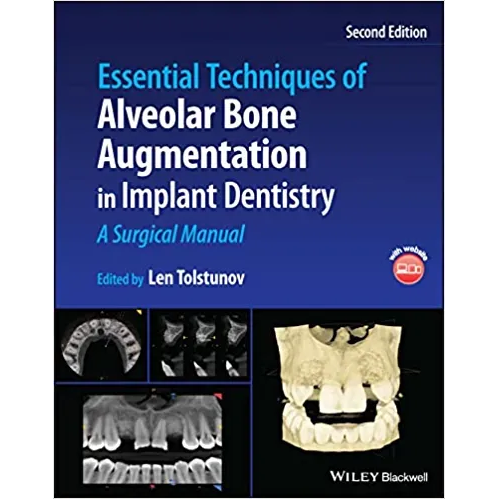 Essential Techniques of Alveolar Bone Augmentation in Implant Dentistry: A Surgical Manual
