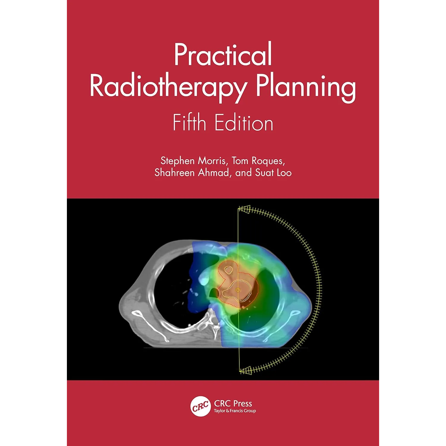 Practical Radiotherapy Planning