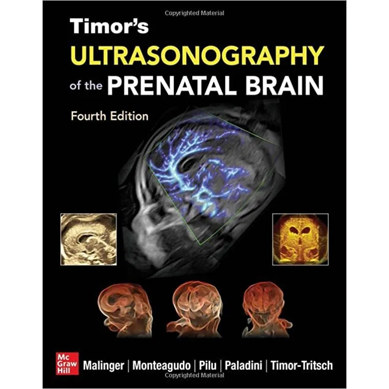 Timor's Ultrasonography of the Prenatal Brain