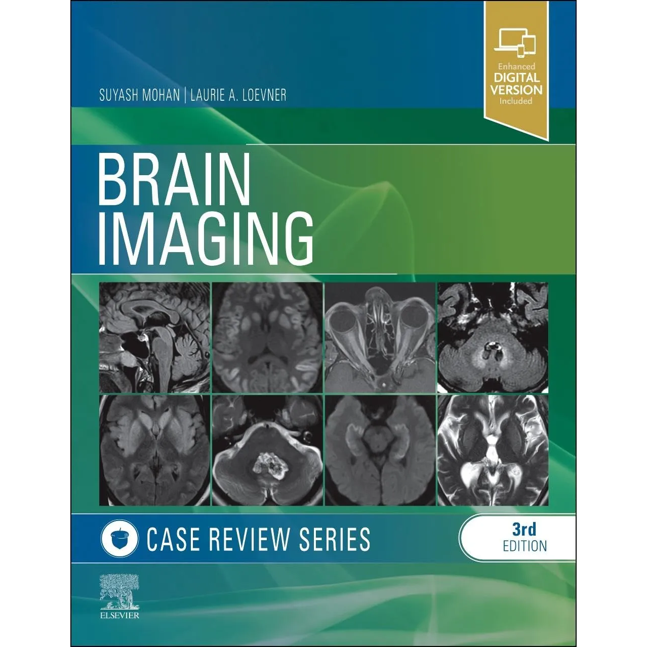 Brain Imaging: Case Review Series