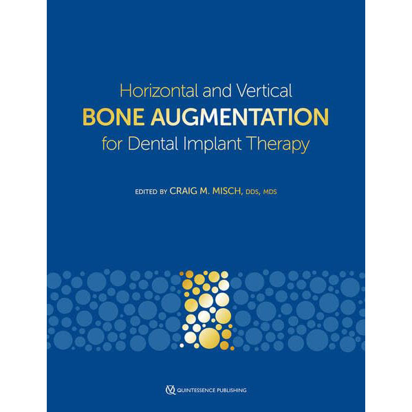 Horizontal and Vertical Bone Augmentation for Dental Implant Therapy