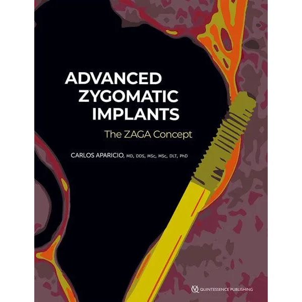 Advanced Zygomatic Implants: The ZAGA Concept