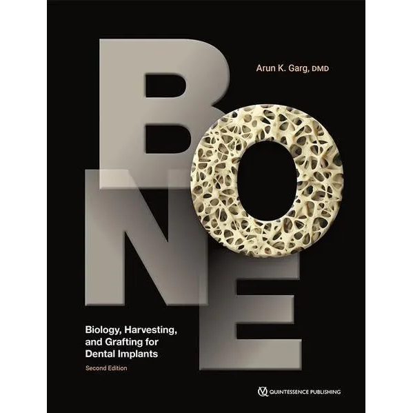 Bone: Biology,Harvesting,and Grafting for Dental Implants