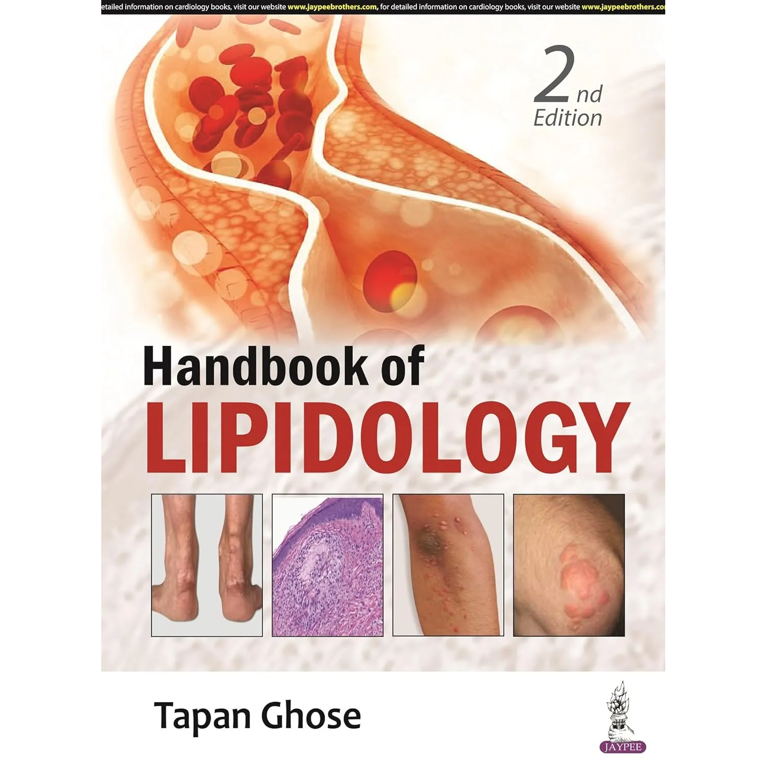 Handbook of Lipidology