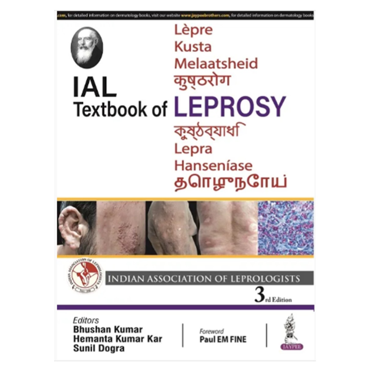 IAL Textbook of Leprosy
