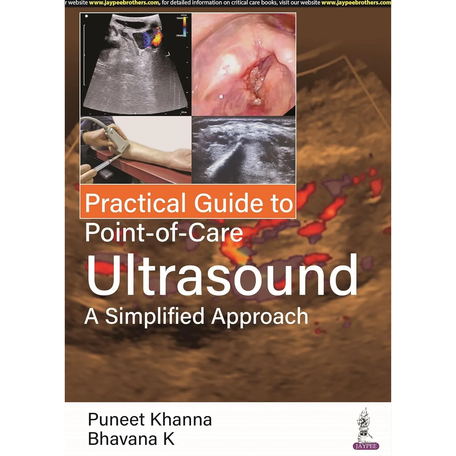 Practical Guide to Point-of-Care Ultrasound: A Simplified Approach