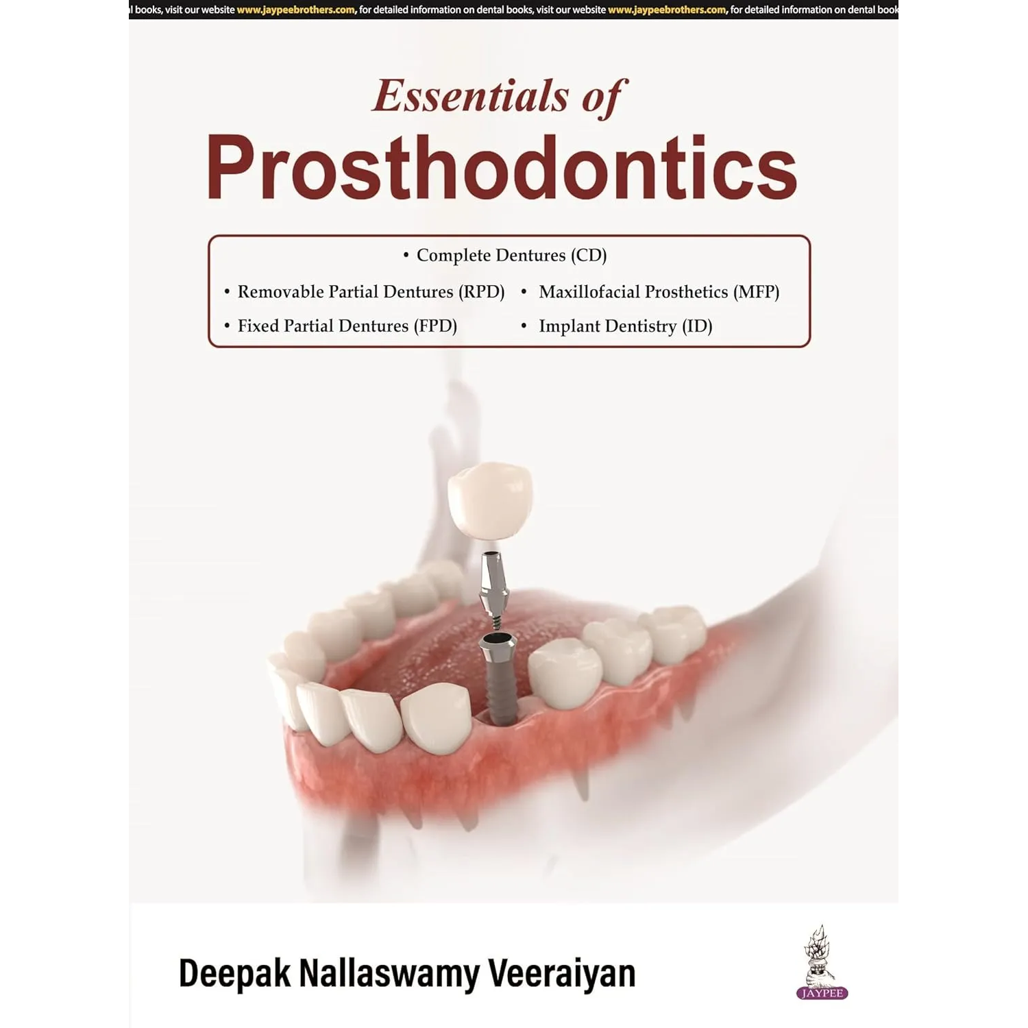 Essentials of Prosthodontics
