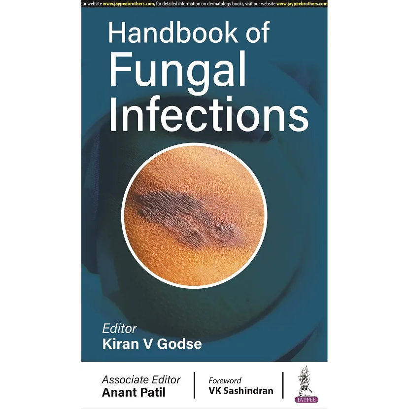Handbook of Fungal Infections