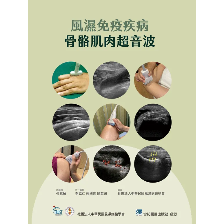 風濕免疫疾病骨骼肌肉超音波